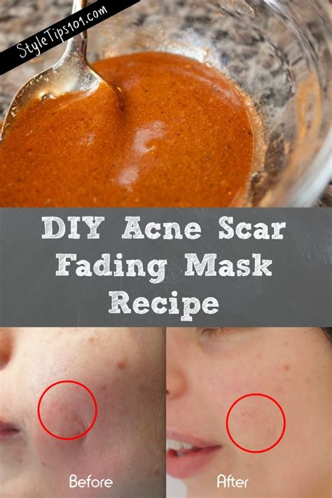 DIY Acne Scar Fading Mask Recipe