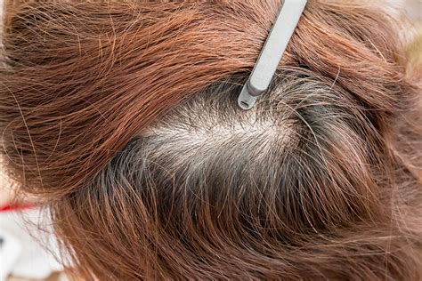 You can actually adopt these tricks and tips so that you can use them in a lot of different hairstyles. Cancer Chemotherapy and Hair Loss: Why It Matters | Wellness | US News