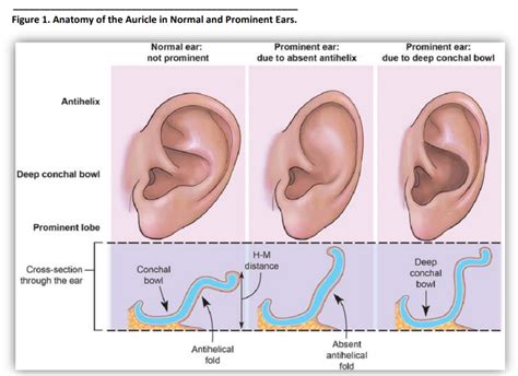 Anatomy Of The Auricle And Prominent Download Scientific Diagram