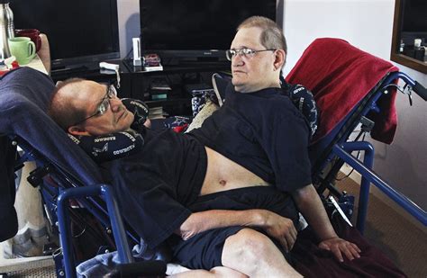 Brother Pays Tribute After Death Of Worlds Longest Surviving Conjoined