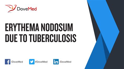 Erythema Nodosum Due To Tuberculosis