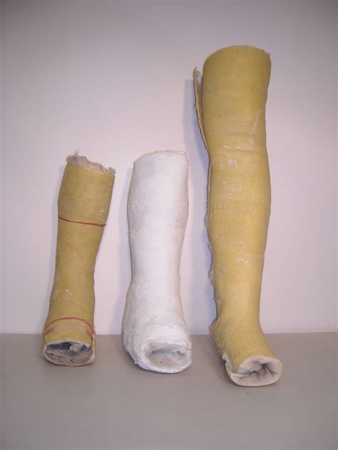 Cast leg