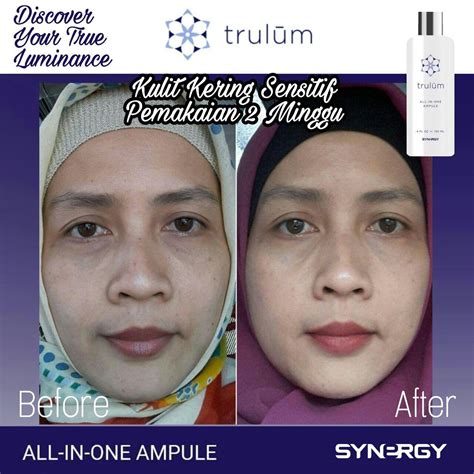 Similar prices to what you would find in usa. WA 08112338376 Di Jual Trulum Synergy Review Obat Flek ...