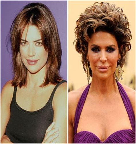 Lisa Rinna Before And After Top 15 Celebs With Plastic Surgery