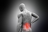 Learn About the Side Effects of Chiropractic Care - Burpengary ...