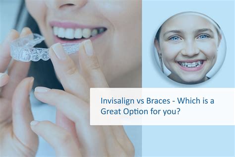 Invisalign Vs Braces Which Is A Great Option For You
