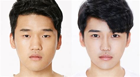 Plastic Surgery For Men The Latest Trends In Korea Eunogo