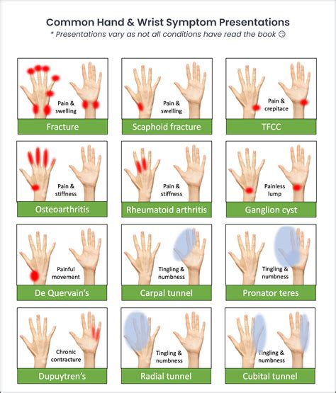 Chiropractic Hand And Wrist Physical Exam ChiroUp