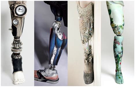 D Printed Prosthetics Addressing Regulations To Accept An Artistic And Accessible Alternative