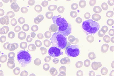 Monocytes Hematomorphology A Databank Imagebank For Hematology