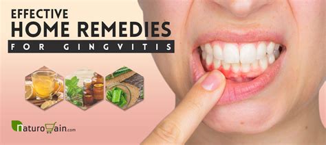 11 Effective Home Remedies For Gingivitis That Work Naturally
