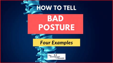 You Probably Have Bad Posture Heres How To Tell The White Coat Trainer