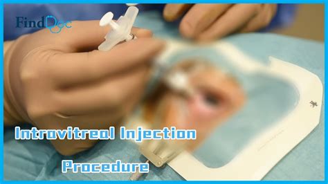 Intravitreal Injection Procedure Demonstration Dr Yip Pui Pui 眼球注射示範