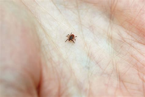 Don T Panic If You Get Bit By A Tick Here Are Tips To Minimize Lyme Shots Health News Npr