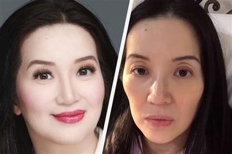 To ‘answer Fear ’ Kris Aquino Undergoes Tumor Marker Tests Abs Cbn News