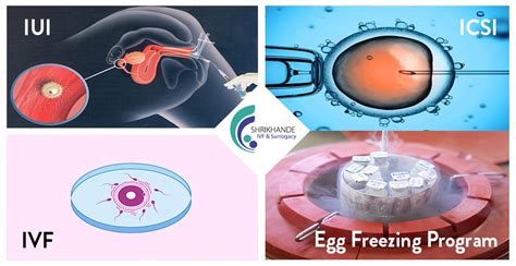 Infertility Treatment Process At Shrikhande Ivf