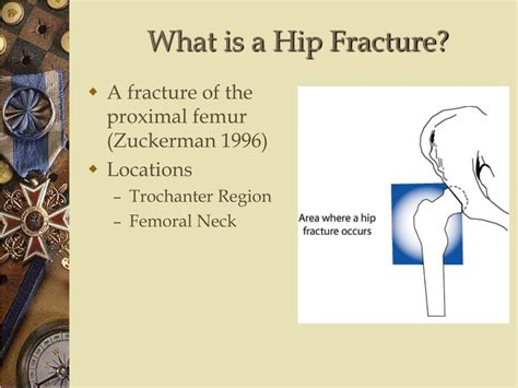 Ppt Hip Fracture Prevention Powerpoint Presentation Free Download