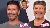 Simon Cowell Plastic Surgery Makeover Exposed By Top Docs