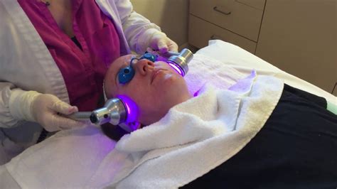 Acne Hydrafacial Treatment W Heather Colon Lpn At Advanced Specialty