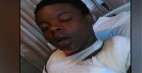 Teen Attacked With Boiling Rice While Sleeping Video Canada Journal
