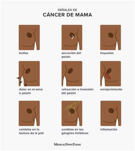 Breast Cancer Symptoms Spanish X Body X Brown Online