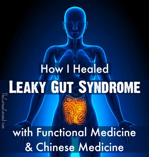 How I Healed Leaky Gut Syndrome With Functional Medicine And Chinese Medicine — The Curious Coconut