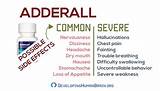 Photos of Adderal  R Side Effects