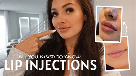 lip injections before during and afternoon process what you need to know youtube