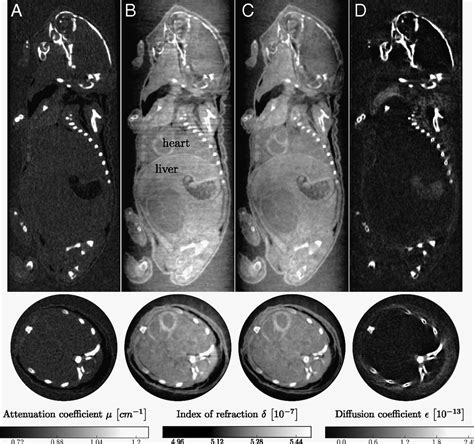 X Ray Phase Contrast Tomography With A Compact Laser Driven Synchrotron