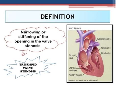 Pin By Nonas Arc On Tricuspid Stenosis Mitral Valve Heart Valves