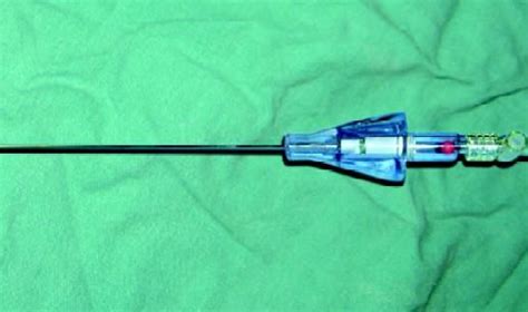 Use Of Veress Needle And Hasson Cannula In Laparoscopic Surgery