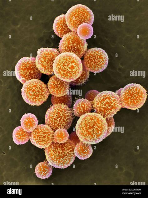 Cryptococcus Neoformans Yeast Sem Stock Photo Alamy