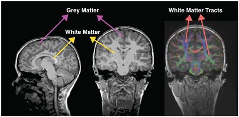 White Matter Counts Brain Connections Help Us Do 2 2 · Frontiers For