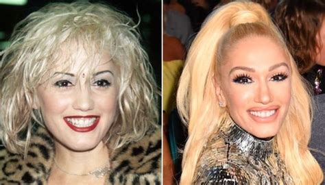 Did Gwen Stefani Underwent Plastic Surgery Read The Complete Facts Here Glamour Fame