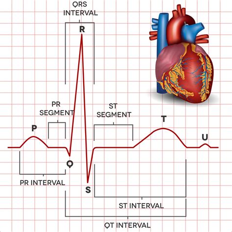 Como Interpretar Um Eletrocardiograma