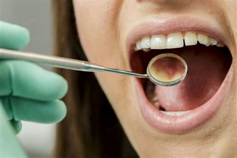 Can Wisdom Teeth Cause Sore Throat Boston Dentist Congress Dental
