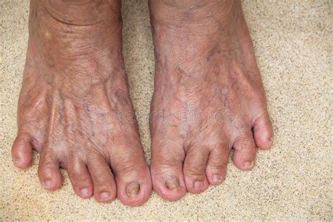 senior woman`s feet are standing on polished stone texture background body concept stock image