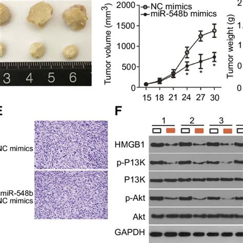 Mir 548b Overexpression Suppresses Tumor Growth Of Hepatocellular