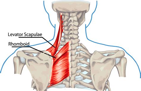 Neck Pain And Levator Scapulae Syndrome Ar