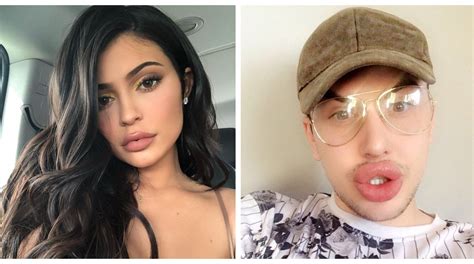 Kylie Jenner Fan Plays Havoc With His Lips In Quest To Get The Perfect