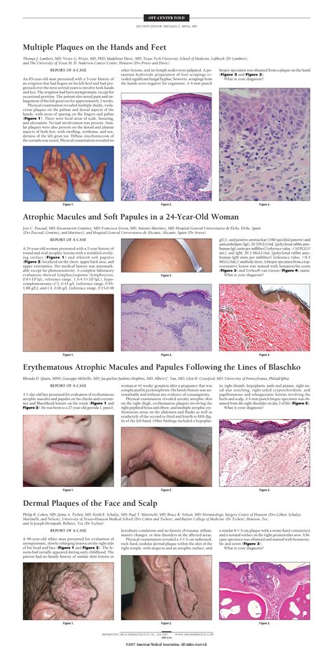 atrophic macules and soft papules in a 24 year old woman—quiz case dermatology jama