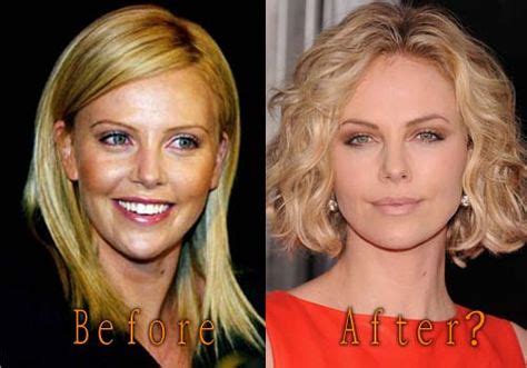 Charlize Theron Plastic Surgery Topcelebritysurgery With Images