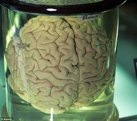 Eureka University Of Texas Finds 100 Missing Brain Specimens After 30