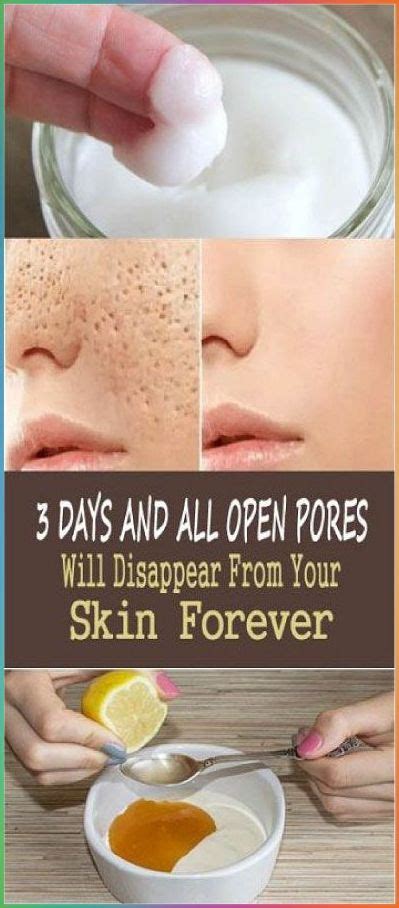 3 Diy Face Masks Pores Will Disappear From Your Skin Forever Skin