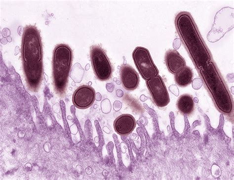 Frontiers Gardnerella Vaginalis As A Cause Of Bacterial Vaginosis