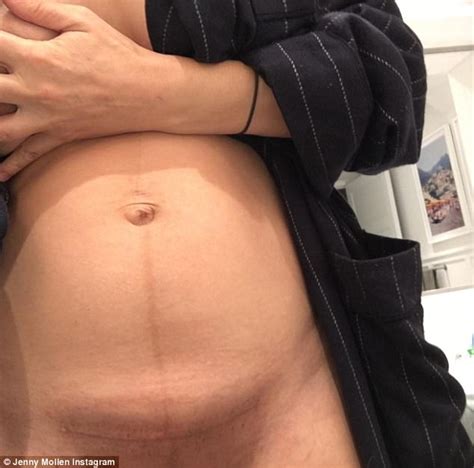 Jenny Mollen Shows C Section Scar After Son S Birth Daily Mail Online