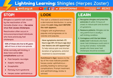 Lightning Learning Shingles — Em3
