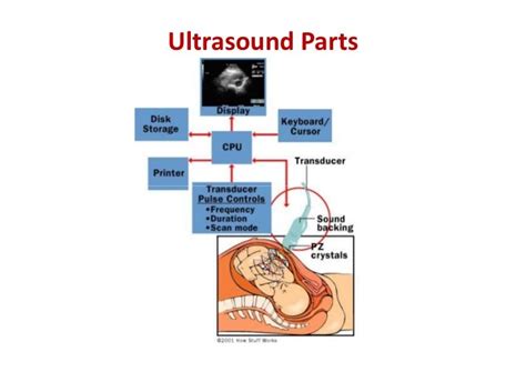 Basics Of Ultrasound