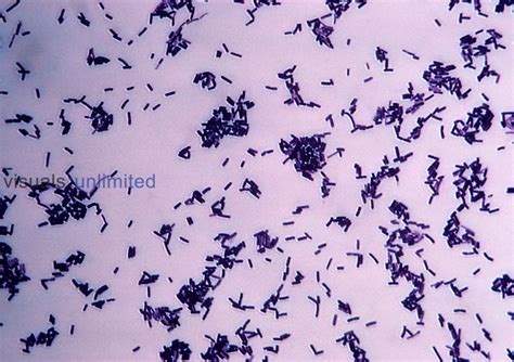 Bacillus Subtilis Gram Positive Bacteria Visuals Unlimited