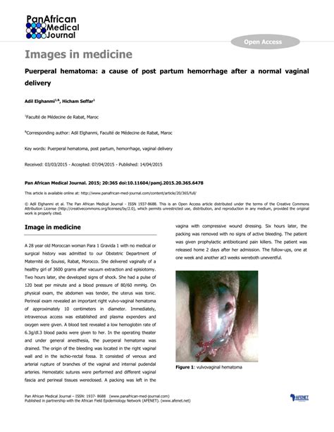 Pdf Puerperal Hematoma A Cause Of Post Partum Hemorrhage After A